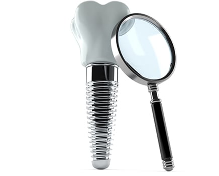 Dental Implants, Ottawa Dentist